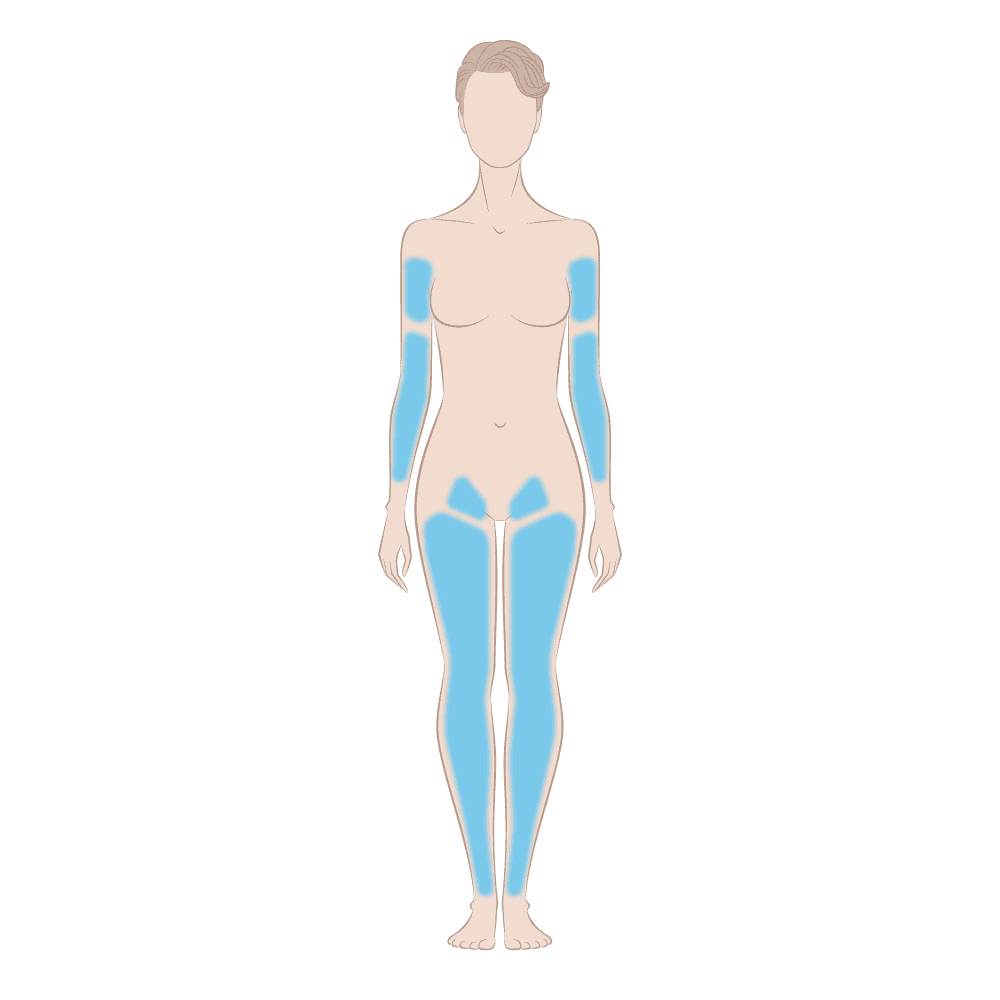 Hair No More Skin Area Diagram