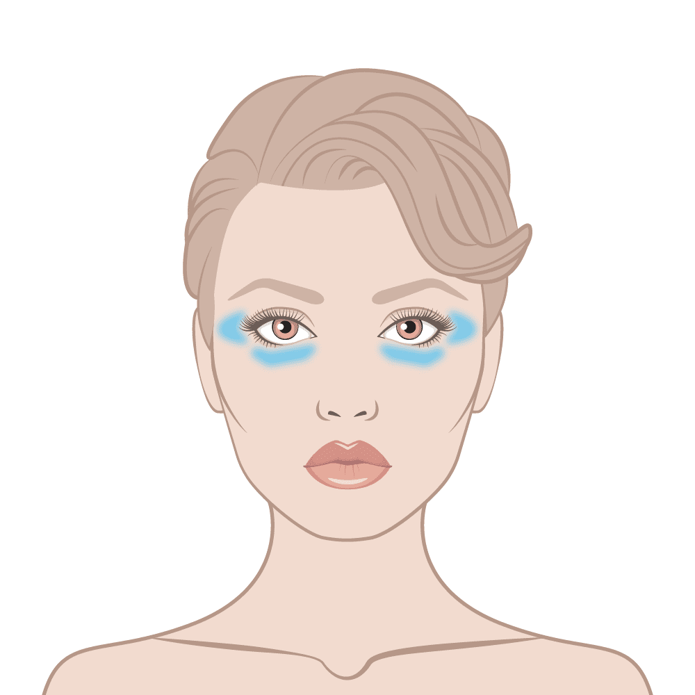 Instant Eyelift Skin Area Diagram