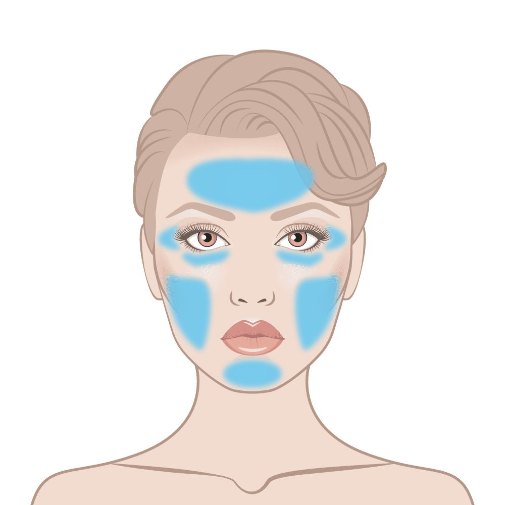 Instant Facelift Skin Area Diagram